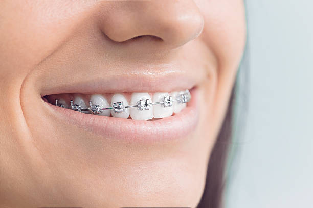 Best Invisalign and Clear Aligners  in Waverly, IL